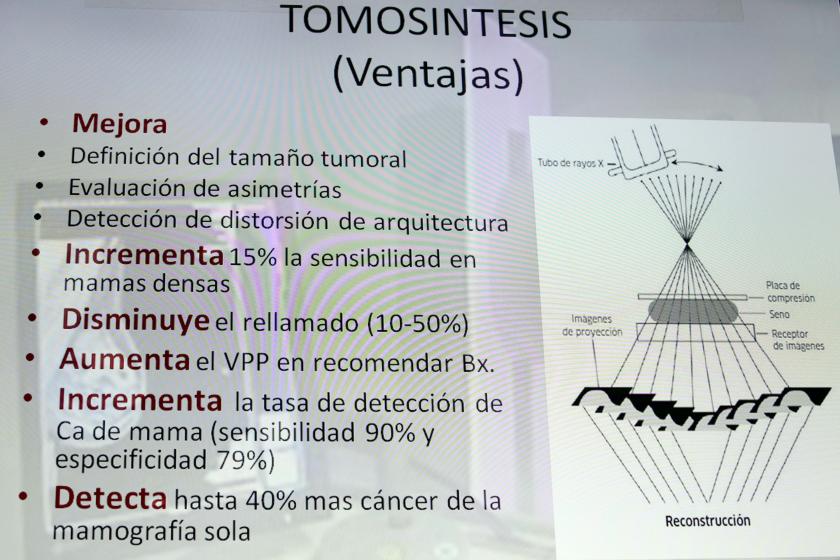 En México han mejorado los programas de detección de cáncer de mama